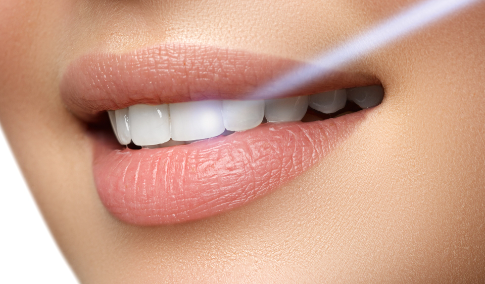 Laser-Dentistry